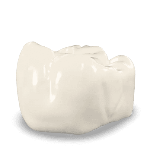 PFM Crowns
